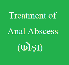 Treatment of Anal Abscess - By Dr. V. B. Mishra - Ayirvedpuram - Allahabad