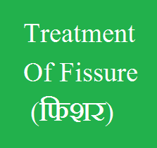 Treatment of Fissue - Using Kshar Sutra Therapy - By Dr. V. B. Mishra